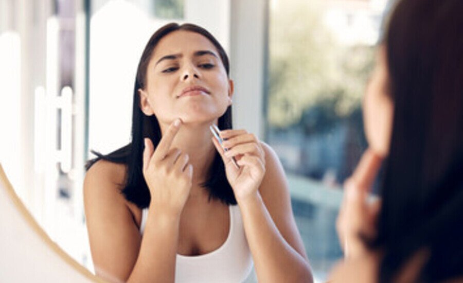 Female Facial Hair intro image